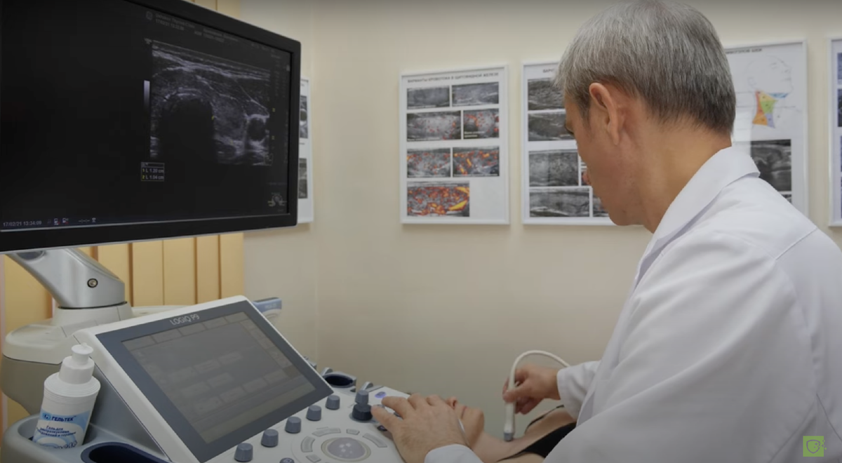 УЗИ щитовидной железы: Узлы и Узловой зоб. TI-RADS. Кровоток. Протокол ...