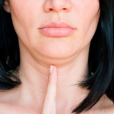 Второй подбородок