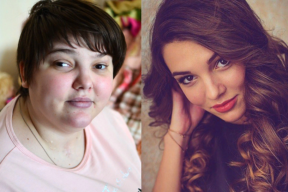 Большие девочки фото до и после проекта. Маша Лебедева. Маша Лебедева Новосибирск сейчас.