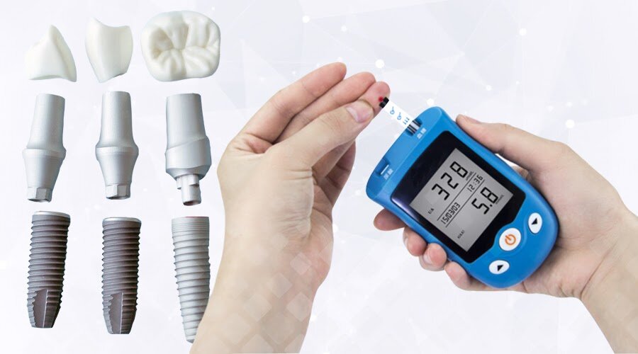 Реальных противопоказаний к имплантации зубов – мало! Более того, имплантация облегчает течение хронических болезней. Фото: Яндекс.Картинки.