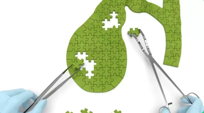 Через несколько месяцев после COVID-19 может развиться повреждение желчевыводящих путей. Фото: Getty images 