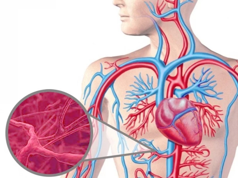 Симптомы, диагностика и лечение васкулита