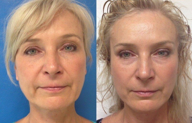 Реальные отзывы профессионалов. Лиана курбанова бизнес тренер. Биомеханика подвижности суставов. Bragin&co логотип. Биодрон фирмы нл.