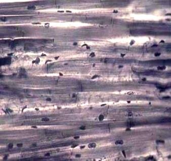 Фото скелетных мышц.