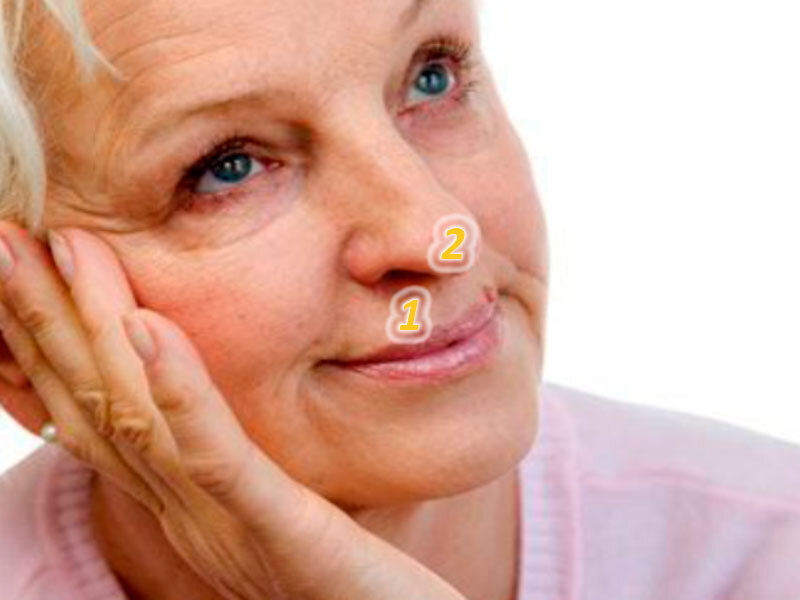 Кончик носа провисает, а верхняя губа отвисает // фото: aif.ru