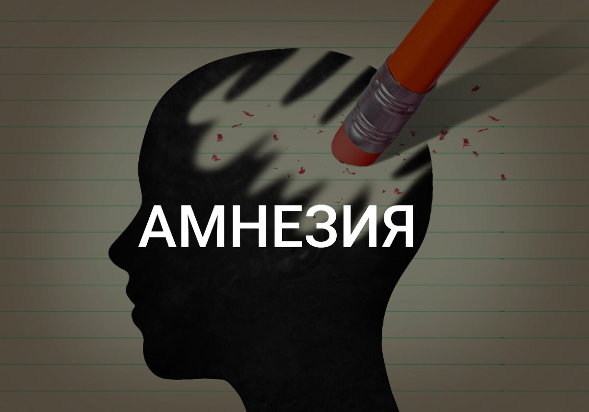 Что в моей голове амнезия