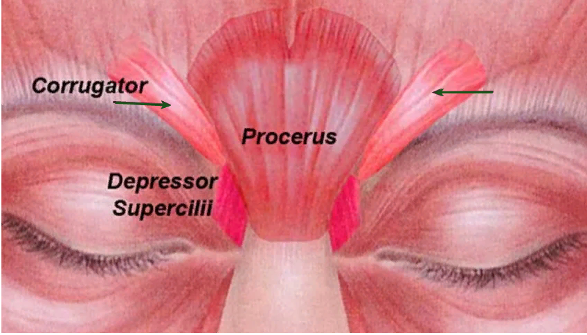 Мышца поднимающая бровь. Corrugator supercilii мышца. Мышца гордецов анатомия. Depressor supercilii мышца. Мышца, сморщивающая бровь m. Corrugator supercilii.