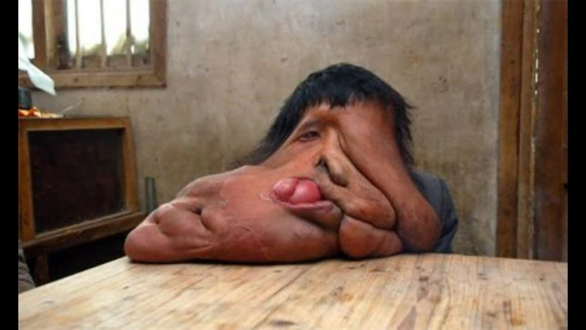 Страшные аномалии тела.