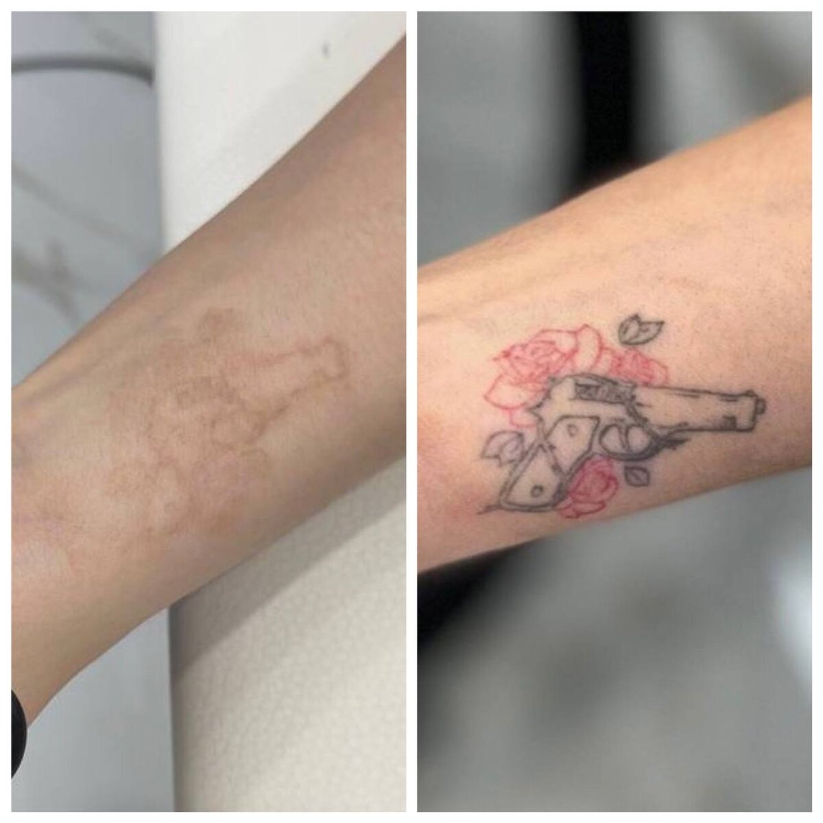 Tattoo allergy: how do I know if I'm allergic to inks ?