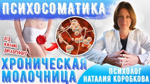 Устранение молочницы народными методами