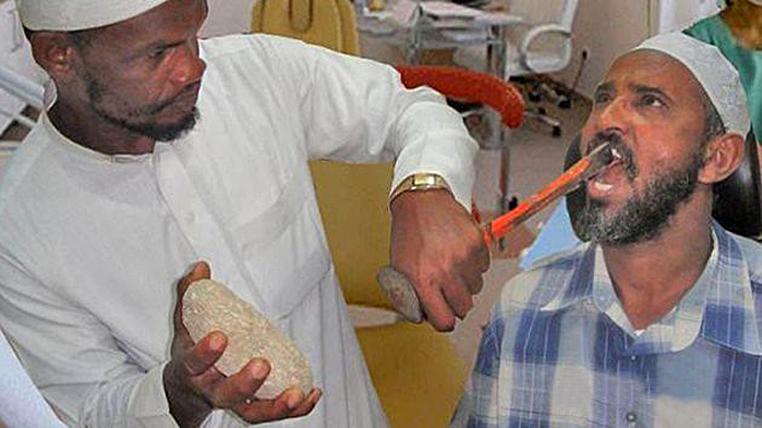 Лечение зубов в Индии