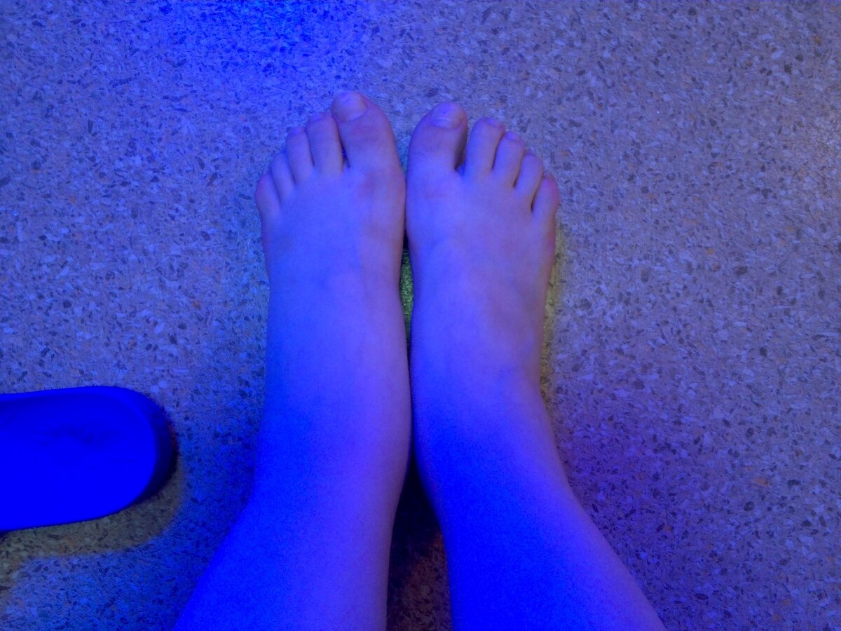 (фотография сделана в темноте, при свете аппарата для уф-терапии) 