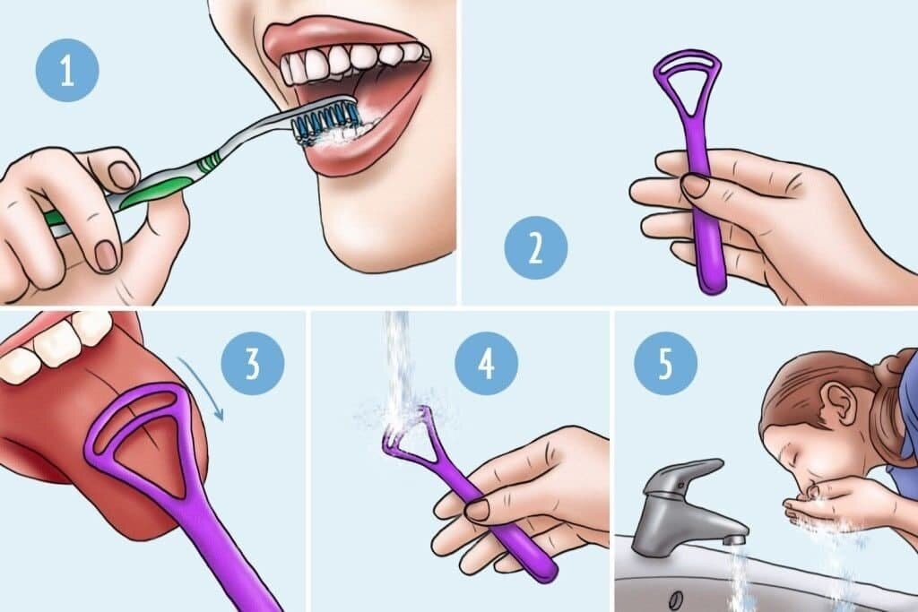 "Правила чистки языка