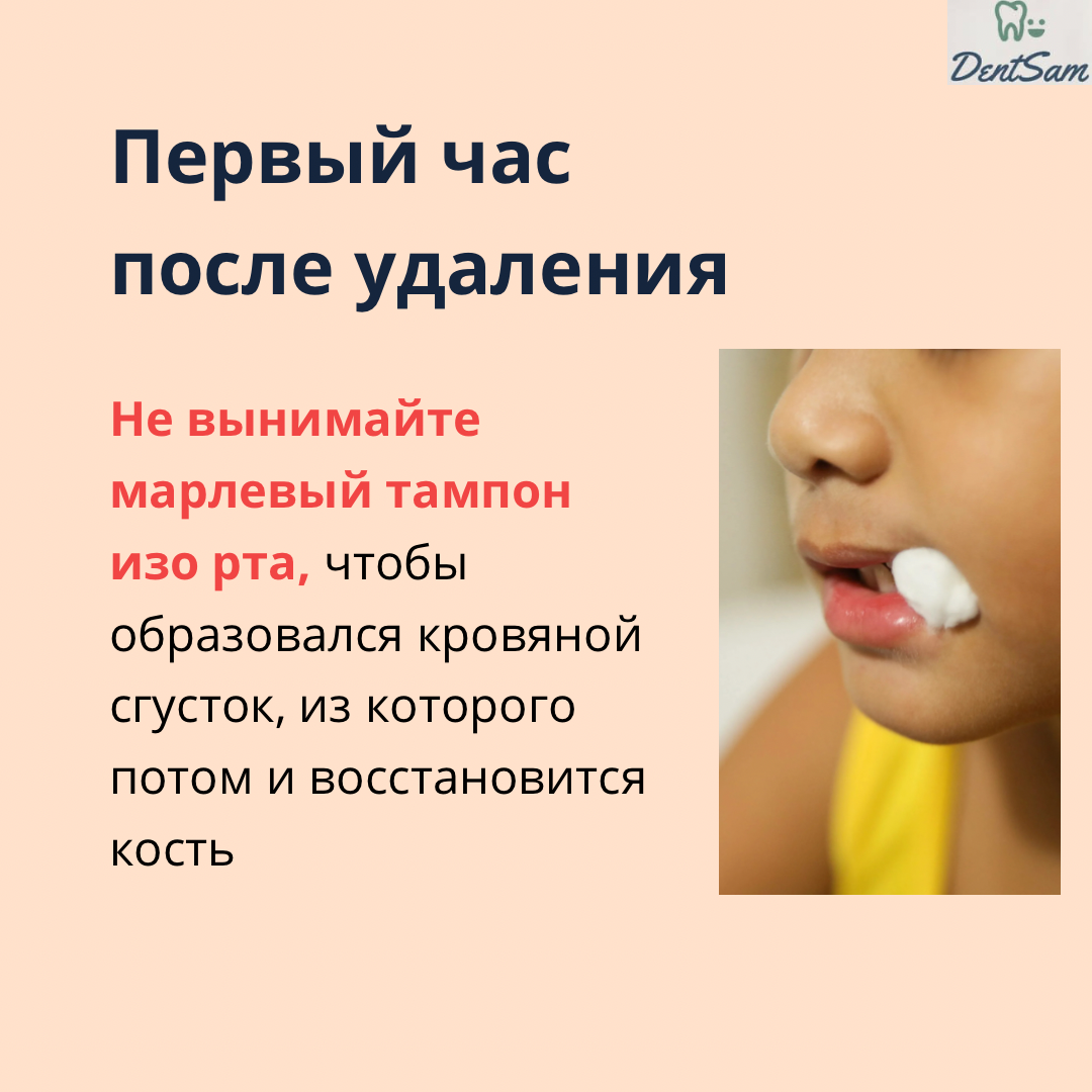 Через сколько есть после удаления зуба. После удаления зуба мудрости рекомендации. Что нельзя после удаления зуба. Что нельзя после удаления зуба мудрости. Что кушать после удаления зуба.