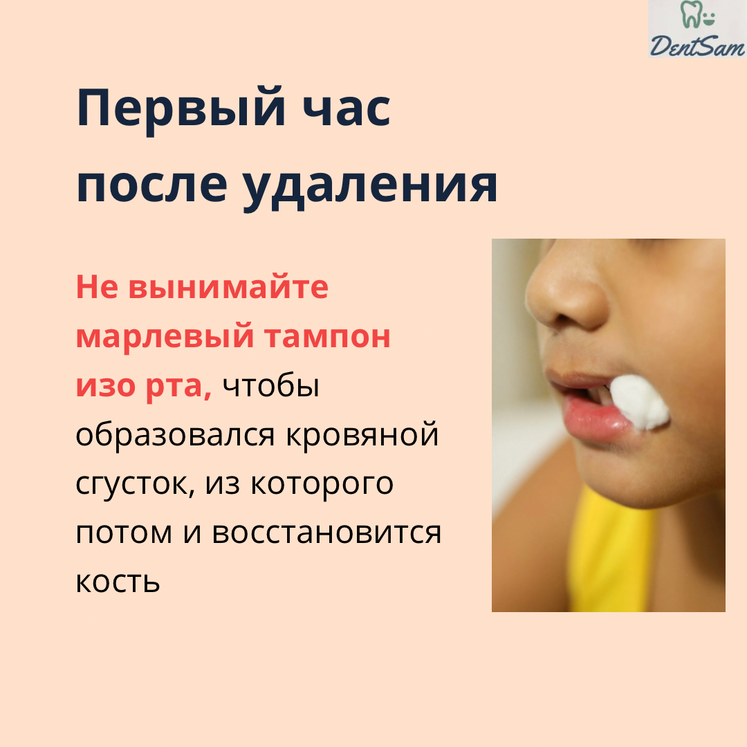 Что делать после удаления зуба. После удаления зуба мудрости рекомендации. Что нельзя после удаления зуба. Что нельзя после удаления зуба мудрости. Что кушать после удаления зуба.