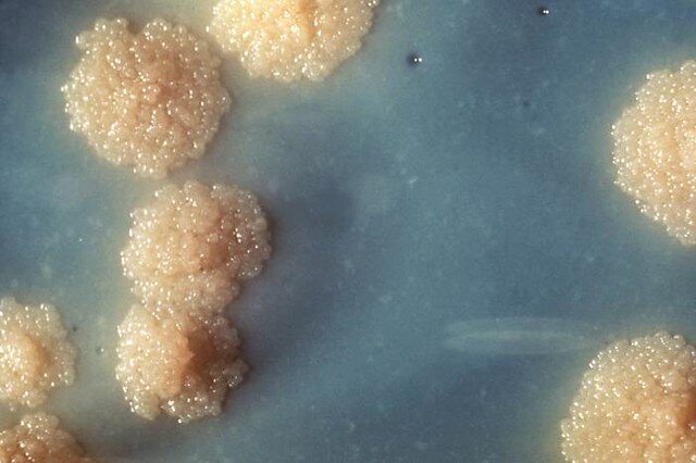 Колонии Mycobacterium tuberculosis. Фото: flickr.com