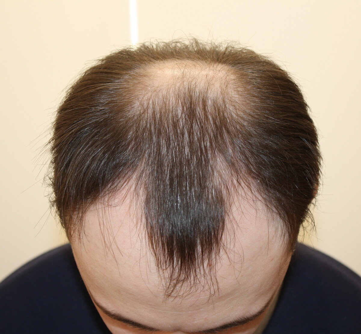 Фото с сайта: domashnie-maski.ru