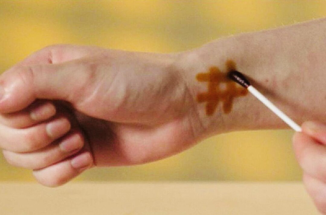 Йодная сетка 