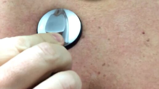 Тоны сердца аускультация стетоскоп stethoscope heart sounds assessment ...