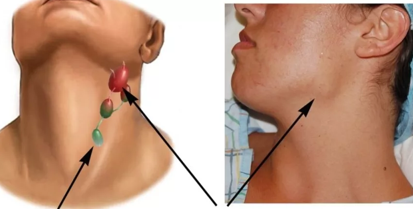 Фотография взята из источника lechenie-simptomy.ru