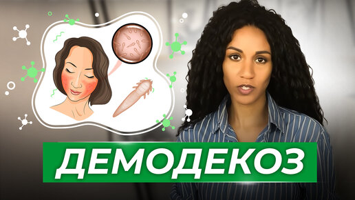 ДЕМОДЕКС // ДЕМОДЕКОЗ: как и чем лечить?