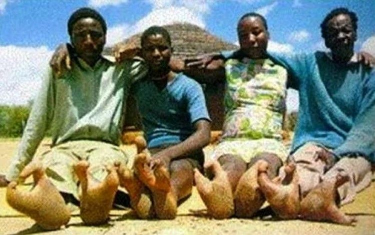 Откуда ноги растут: история двупалых — загадочного племени «‎людей-страусов»