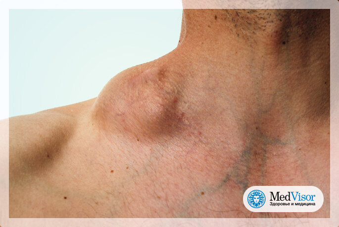  Designed by Gabor Kenyeres/Shutterstock