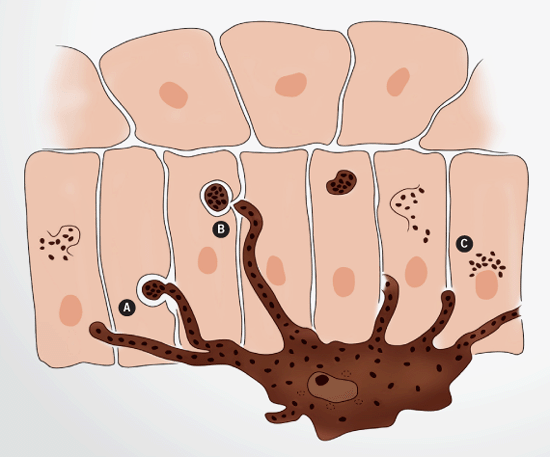 Транспорт гранул меланина в клетке (https://eliasandwilliams.com/pigmented-skin-more-acidic/)