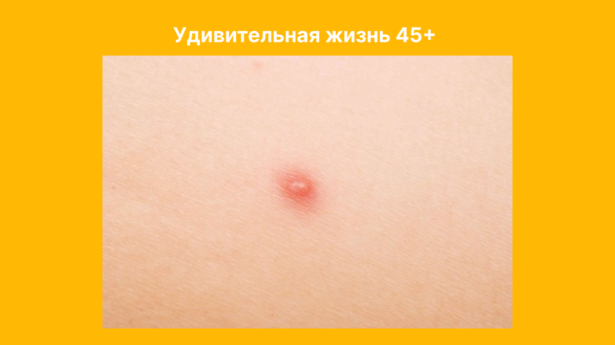 Фотография взята из открытых источников