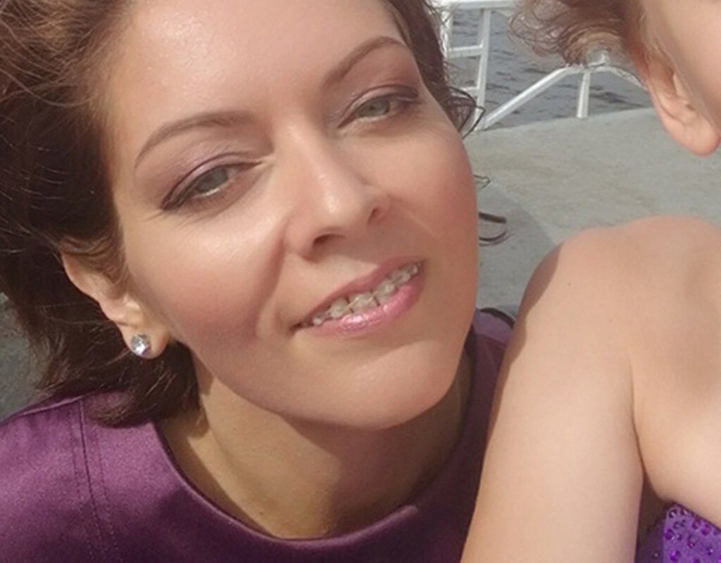 Август, ношу брекеты больше двух лет, снимут в ноябре. На фото я с племянницей, она тоже в брекетах. Из этических соображений ее не покажу. Осторожно, следующее фото не симпатичное - мои неровные зубы крупным планом, сразу же после установки нижней системы.