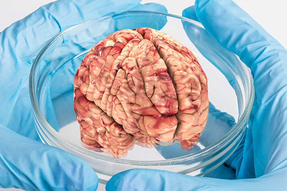 Мозг человека как лечить. Мозг человека как лечить. Мозг и нервная система. Мозг человека как лечить. Искусственный мозг человека.