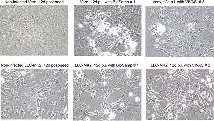 Смешанные цитопатические эффекты в клетках Vero E6 и LLC-MK2 [8]