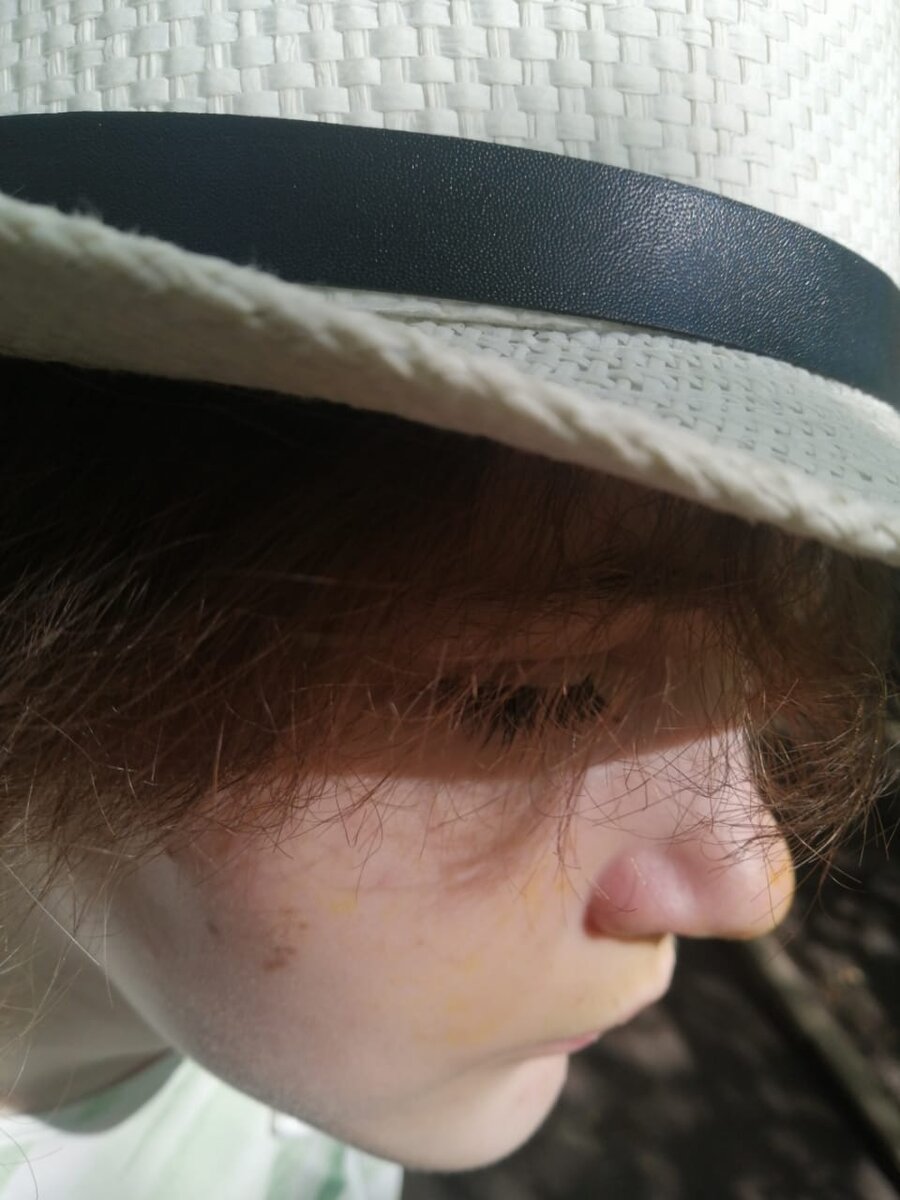 Алюша в одуванчиках 