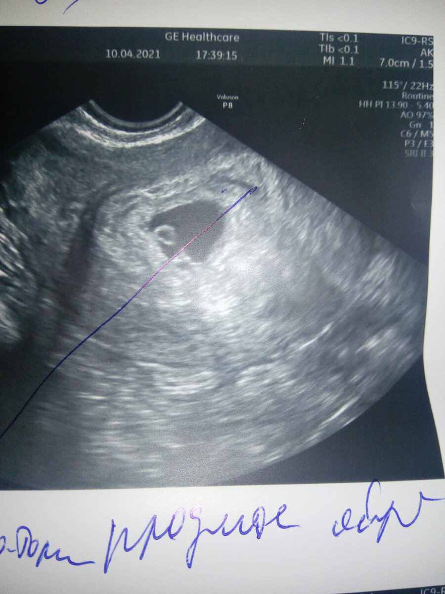 Вот она "красавица"