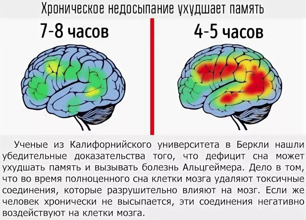 Особенности работы мозга. Сон и мозг. Активность спящего мозга. Влияние сна на мозг. Влияние сна на мозговую деятельность.