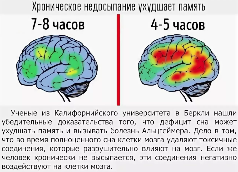 Как проверить мозг. Влияние сна на мозг человека. Влияние сна на память.