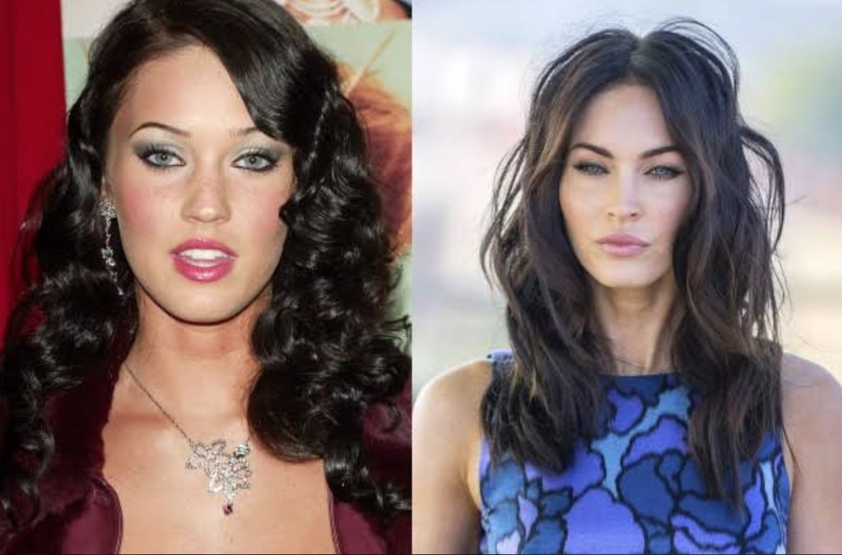 Звездное преображение. Ляйсан утяшева. Звездное преображение. Николь кидман улыбка до и после. Звездное преображение.