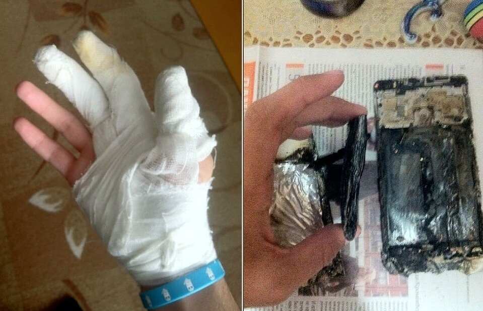 У школьника взорвался мобильный телефон прямо в кармане на улице. 
9-классник Егор Головин пошел в школу и по дороге услышал хлопок. Обернувшись назад он не увидел ничего подозрительного и пошел дальше, но сразу же почувствовал сильное жжение в районе заднего кармана.

