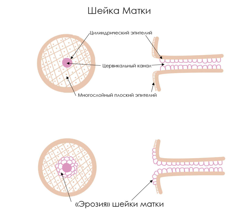 Схема шейки матки