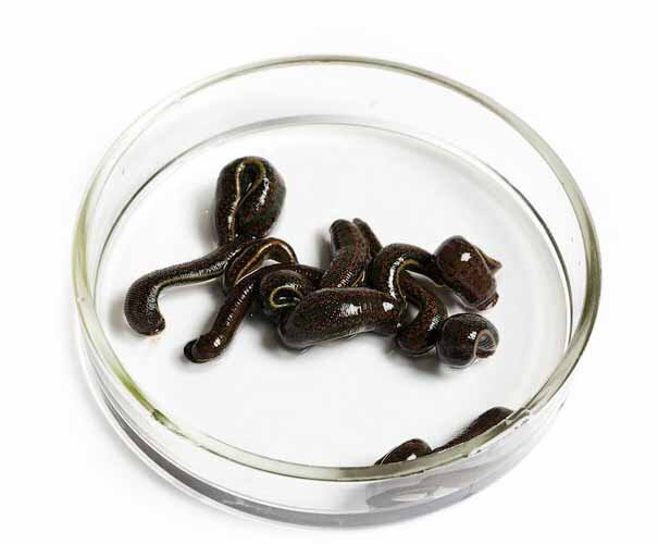 пиявки. сервис яндекс.картинки  