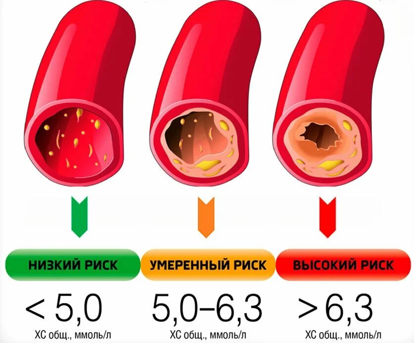 Рис. 1 В разрезе