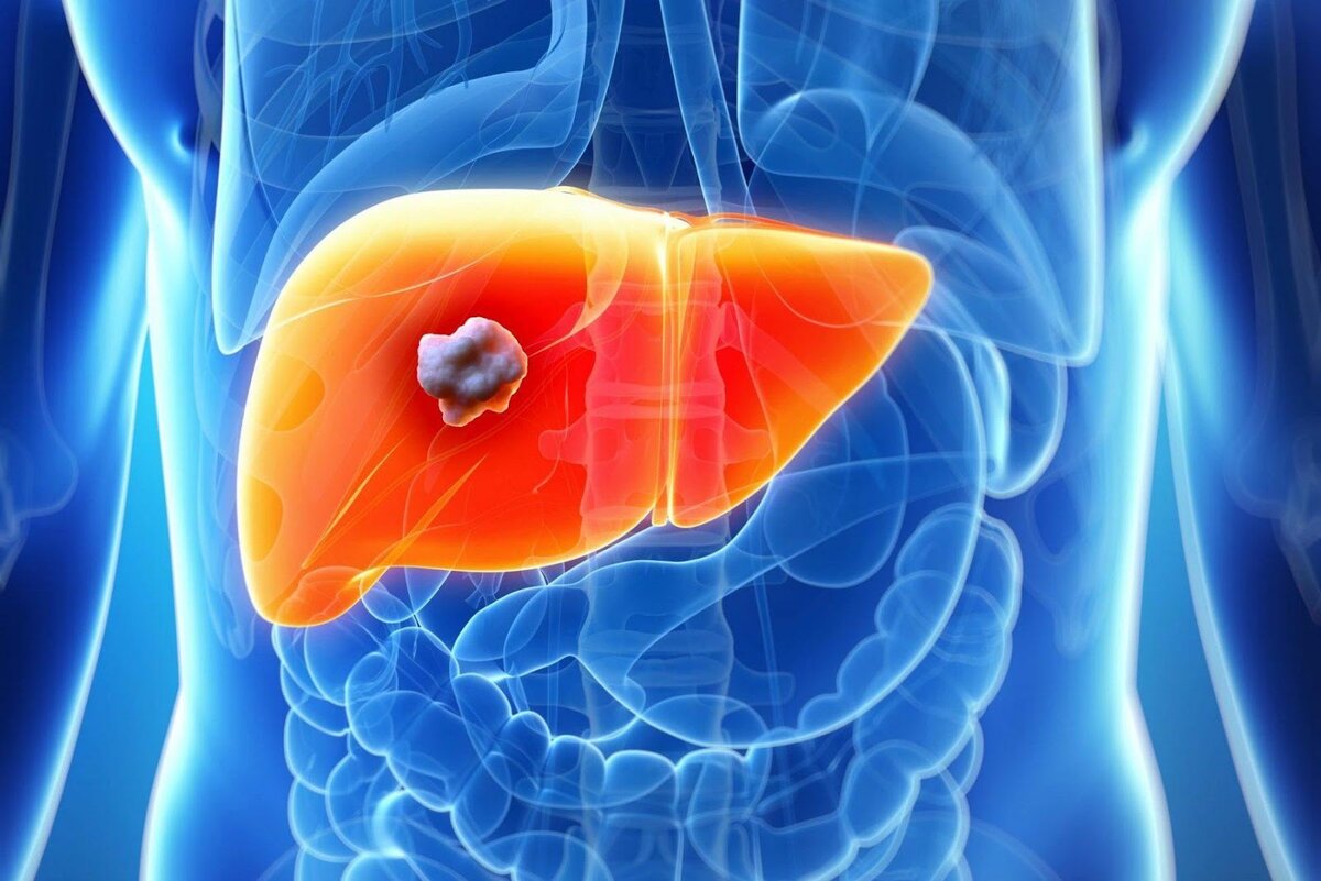 Cystic formations of liver