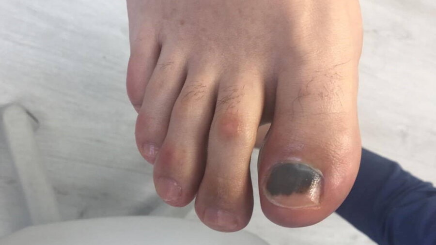 Какие симптомы указывают на необходимость операции