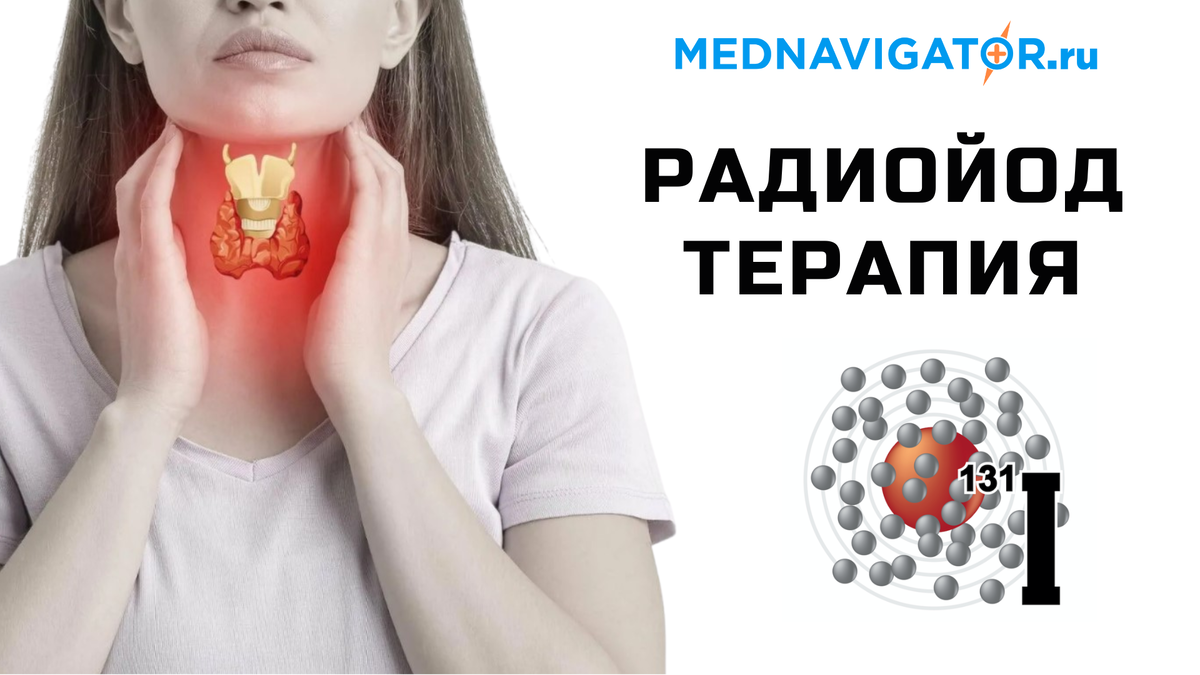 РАДИОЙОДТЕРАПИЯ ЩИТОВИДНОЙ ЖЕЛЕЗЫ - показания, возможности, до и после ...