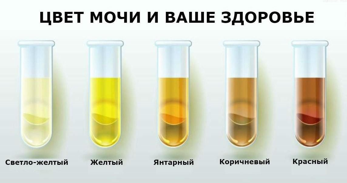 Темная моча у женщин. Цвет мочи. Желтый цвет мочи. Нормальный цвет мочи. Соломенный цвет мочи.