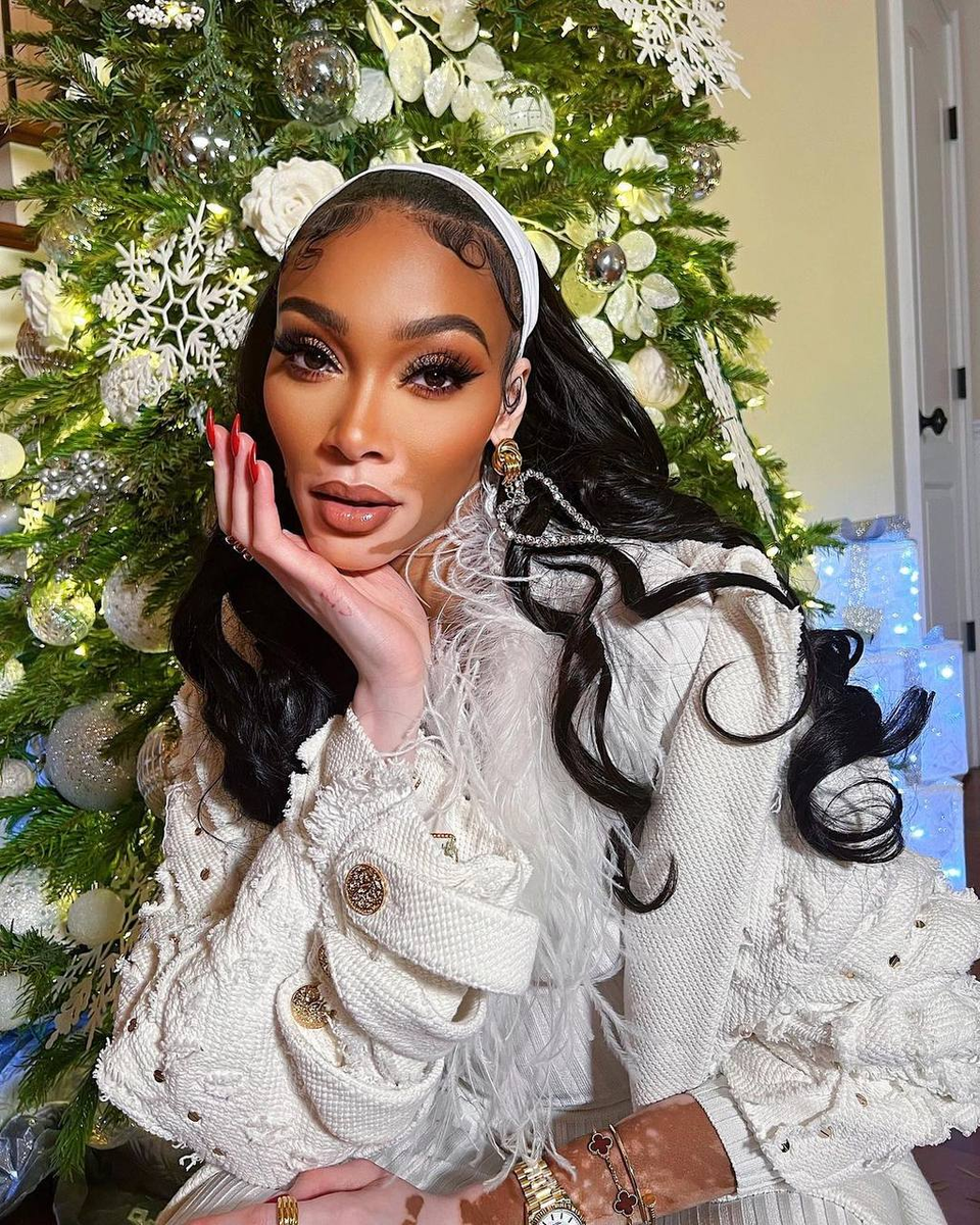 Фото: Винни Харлоу (англ. Winnie Harlow) Instagram 