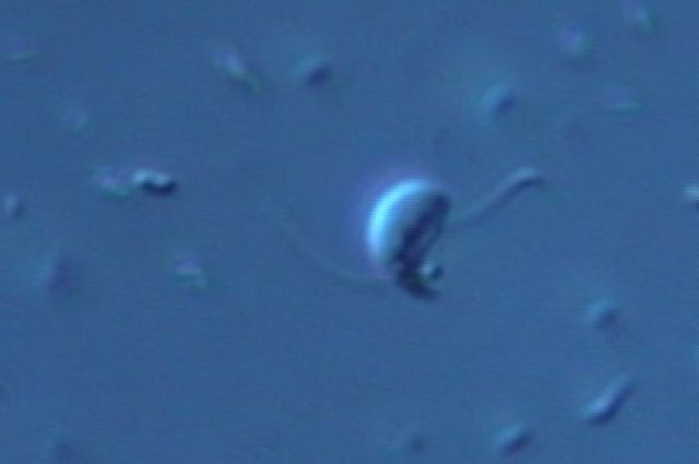    Что за хищных микробов, загрызающих своих жертв, открыли наши учёные?