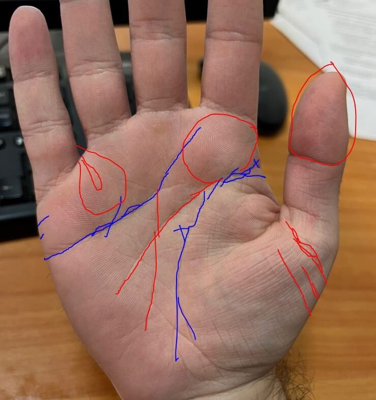 -2