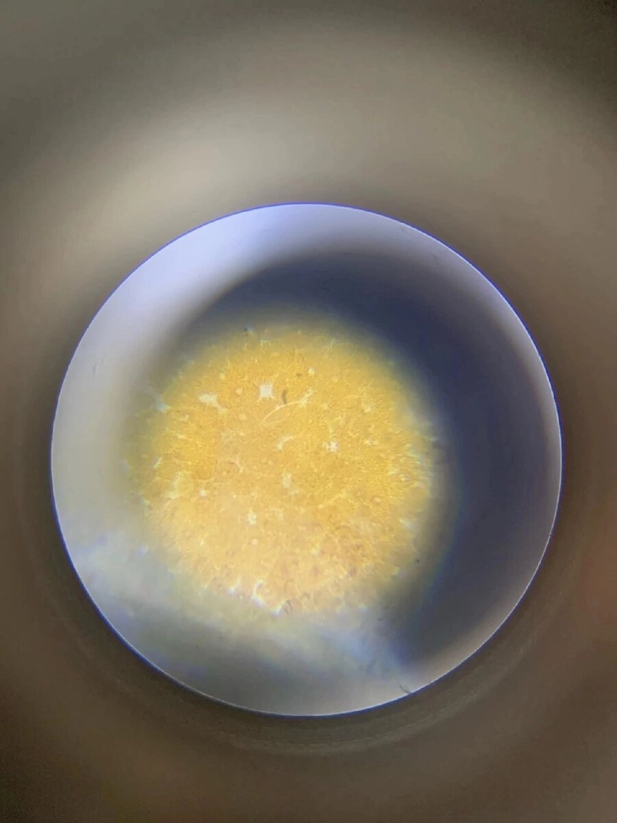 Желточные включения в бластомерах амфибии