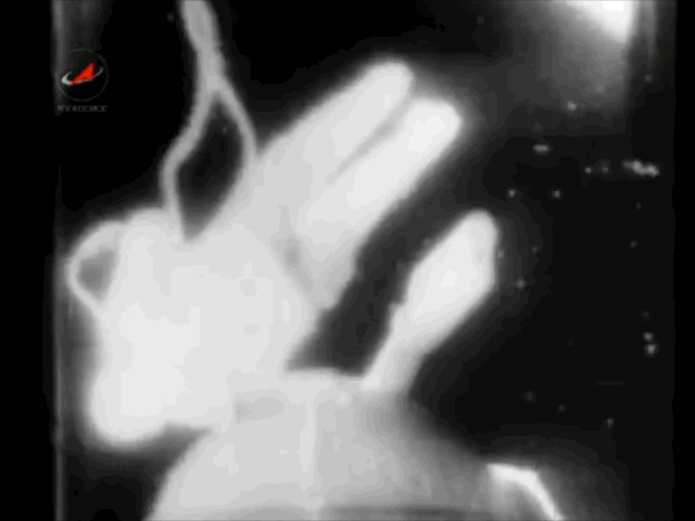 -4
